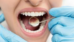 ما هي طرق العناية الخاطئة التي تسبب تسوس الأسنان ؟