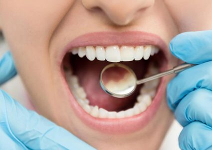 ما هي طرق العناية الخاطئة التي تسبب تسوس الأسنان ؟