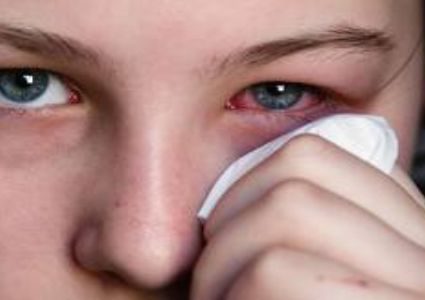 6 وصفات طبيعية لعلاج حساسية العين