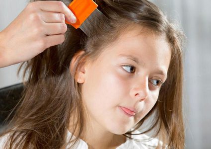 طبيب صحة عامة: نصائح لتفادي الاصابة بقمل الرأس