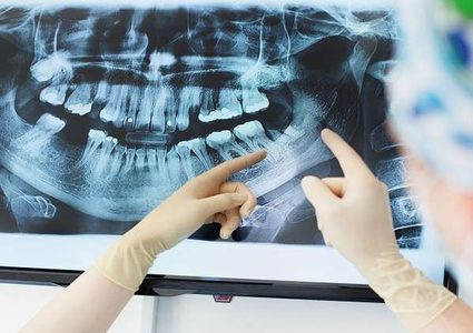 سبب مرض الزهايمر قد يعيش داخل فمك!