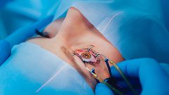 ما هو الحل الأفضل..النظارات الطبية أم عمليات الليزر ؟