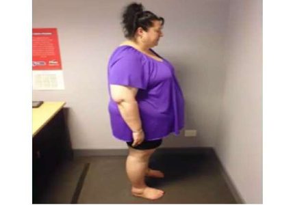 الخوف يفقد أسترالية نصف وزنها