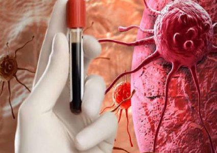 اكتشاف سبب ظهور سرطان الدم