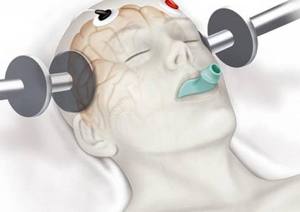 باحثون:  علاج الاكتئاب الصدمة الكهربائية غير آمن ويجب إيقافه