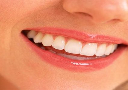 متى تكون بقع الأسنان مقلقة؟