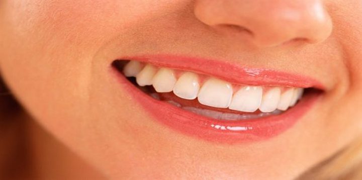 متى تكون بقع الأسنان مقلقة؟
