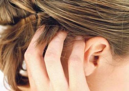 علاجات منزلية للتخلص من حكة الرأس