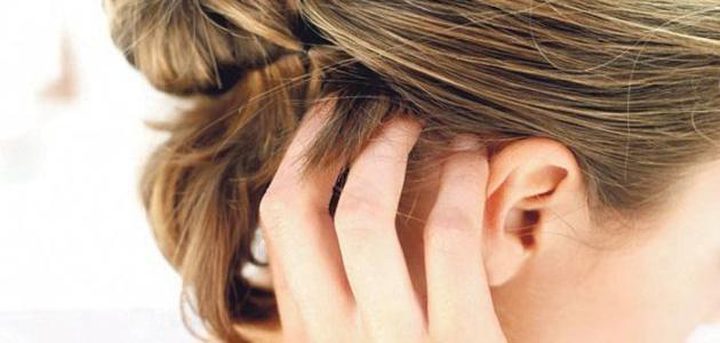 علاجات منزلية للتخلص من حكة الرأس