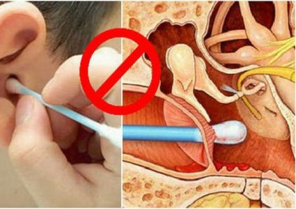 هل تؤدي أعواد القطن إلى فقدان السمع؟
