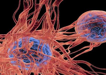 اكتشاف "المنشأ الأصلي" للسرطان!