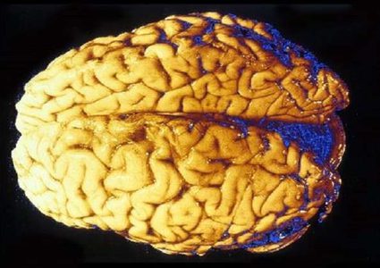 سبب غير متوقع لتطور دماغ الإنسان