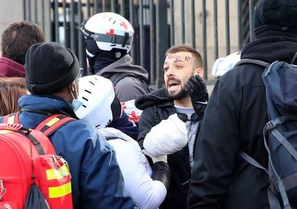 قنبلة تبتر أصابع أحد محتجي "السترات الصفراء"