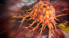دراسة: اكتشاف علاج "خارق" لقتل الخلايا السرطانية