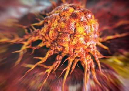 دراسة: اكتشاف علاج "خارق" لقتل الخلايا السرطانية
