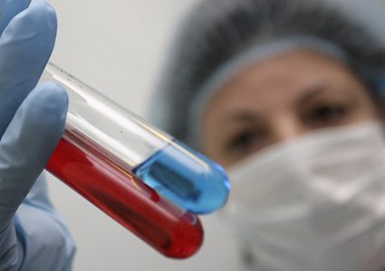 طالبة عراقية تتوصل إلى اكتشاف علمي"مذهل"بمجال علاج الايدز