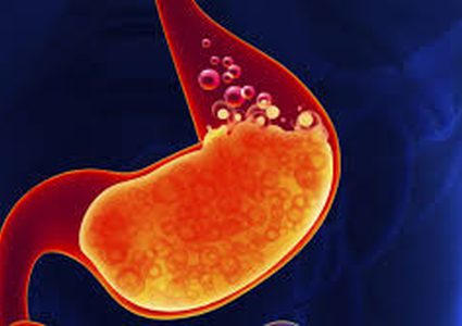 10 أغذية طبيعية تخلصك من حرقة المعدة