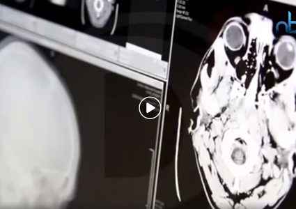 دماغ المرأة أكثر شبابا من دماغ الرجل