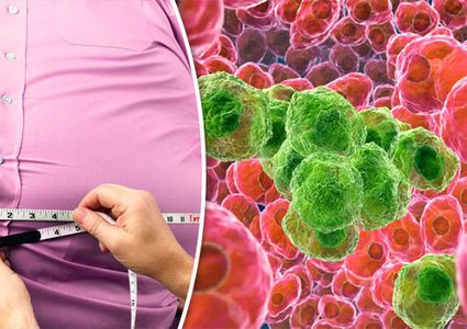 7 أنواع من السرطان تسببها السمنة