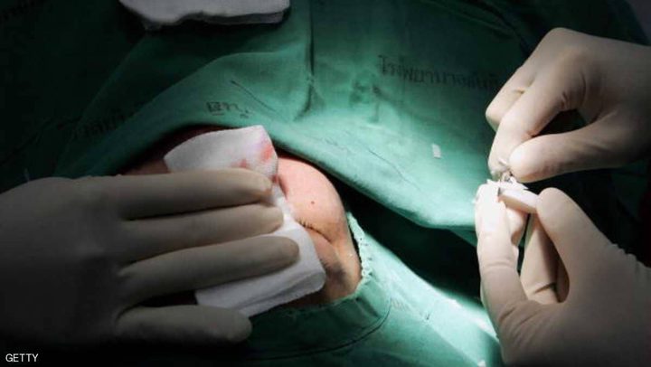 عمليات تجميل الأنف.. معلومات ومخاطر