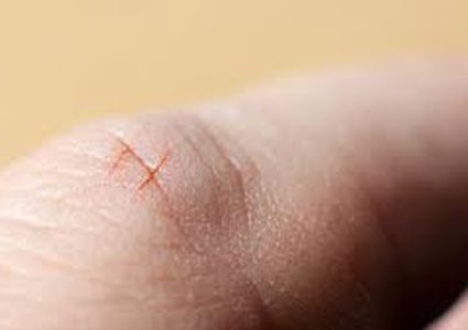 لماذا تتسبب جروح الورق بألم كبير في الأصابع