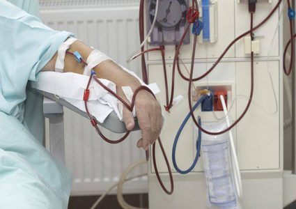 مرضى الفشل الكلوي أكثر عرضة للإصابة بمرض السرطان