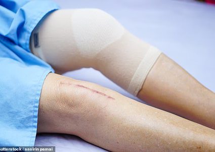 معظم عمليات استبدال مفصل الورك والركبة الحديثة تدوم 25 سنة