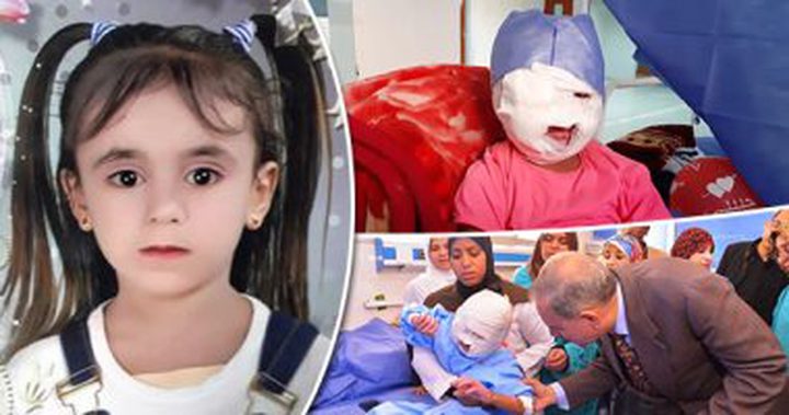 نوران صعدت للعب أعلى سطح منزلها فأحرقها صعق كهربائى