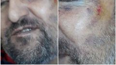 الاحتلال يعتدي بشكل همجي على مواطن كفيف