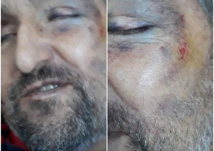 الاحتلال يعتدي بشكل همجي على مواطن كفيف