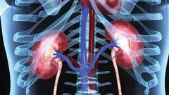 ما هي أعراض الفشل الكلوي ؟