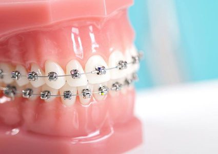 كيف تسبب الأسنان الملتوية مشاكل هضمية ؟