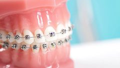 كيف تسبب الأسنان الملتوية مشاكل هضمية ؟