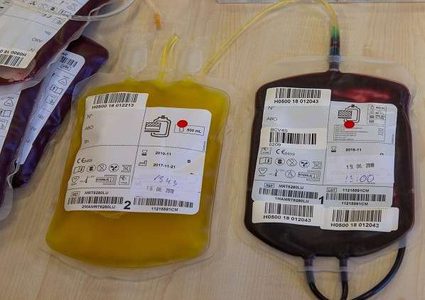 كشف خطر استخدام "الدم" لمكافحة الشيخوخة