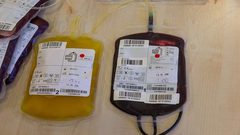 كشف خطر استخدام "الدم" لمكافحة الشيخوخة