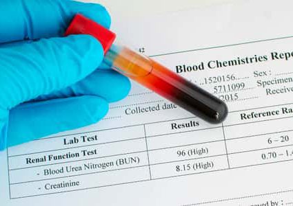 6 نصائح لخفض نسبة الكرياتينين في الدم