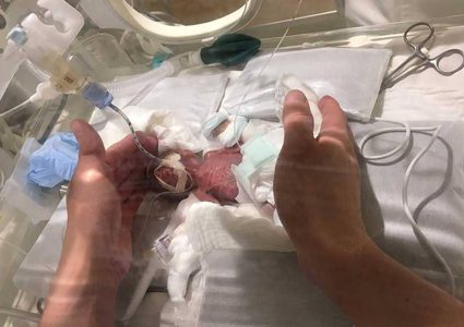 أصغر رضيع في العالم يحقق "المعجزة" ويغادر المستشفى