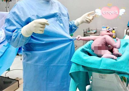 "رجعنى جوا تانى".. رضيع يمسك بملابس الطبيب عقب ولادته بلحظات
