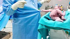 "رجعنى جوا تانى".. رضيع يمسك بملابس الطبيب عقب ولادته بلحظات