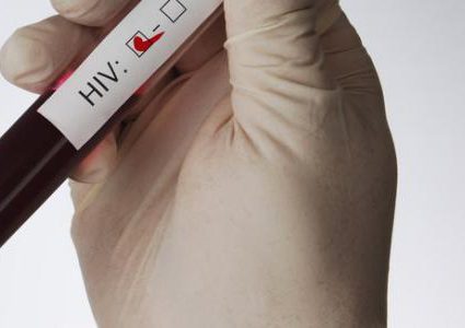 اختفاء فيروس الإيدز من ثالث مريض في العالم