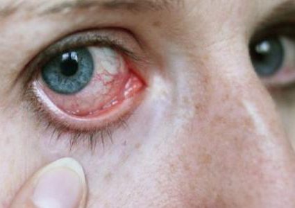 ما هي الأمراض التي تكشف عنها العين ؟