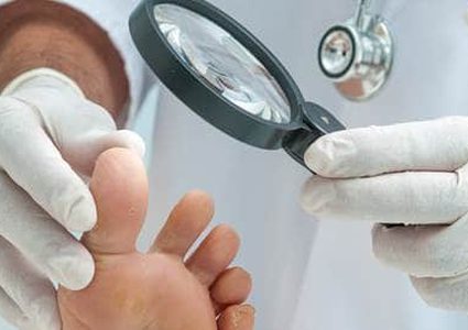 زيت شجرة الشاى وجوز الهند لعلاج فطريات الجلد