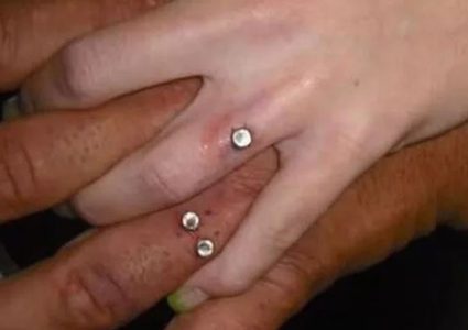 خبيرة علاقات ترد على موضة تركيب خاتم الخطوبة فى اللحم