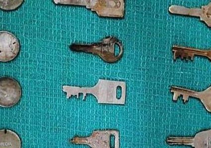 الهند.. استخراج 40 قطعة معدنية من معدة "الرجل المغناطيس"