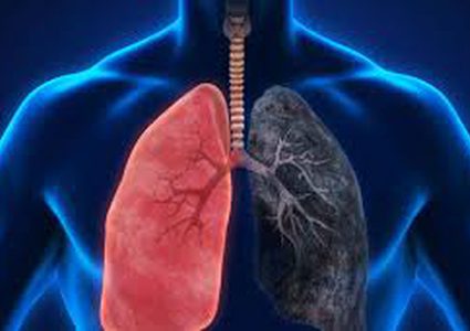 علاجات زيت القنب تقلص أورام سرطان الرئة إلى نصف حجمها