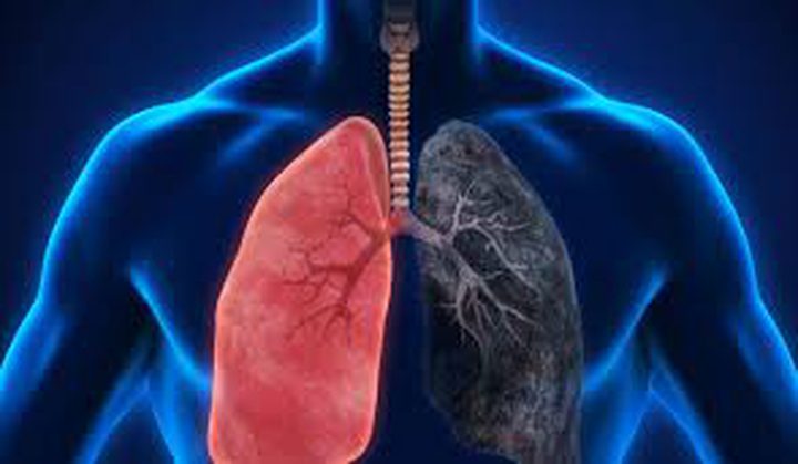 علاجات زيت القنب تقلص أورام سرطان الرئة إلى نصف حجمها