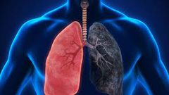 علاجات زيت القنب تقلص أورام سرطان الرئة إلى نصف حجمها