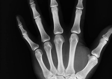 كيف تحمي عظامك مع تقدمك في العمر