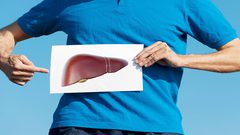 اعراض خمول الكبد ونصائح للوقاية منه