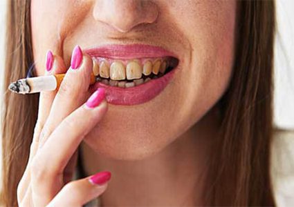 ليس فقط التدخين ..7 أطعمة لها نفس تأثير السجائر على صحة أسنانك